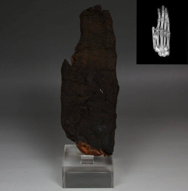 Egyptian mummified hand with X-Ray