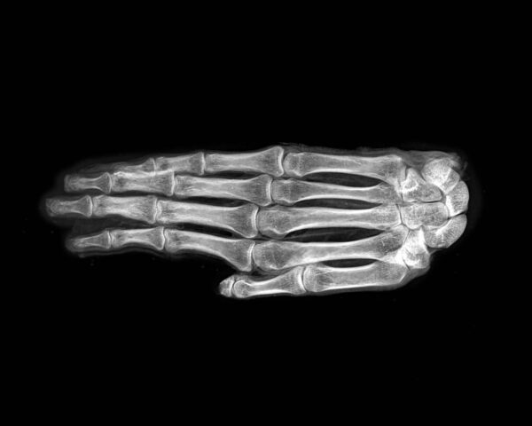 Egyptian mummified hand with X-Ray